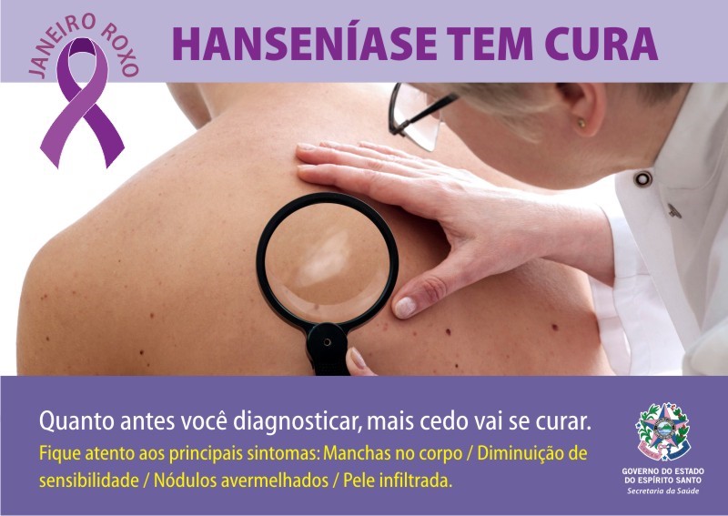 O que é a hanseníase? Conheça os sintomas e como é feito o diagnóstico