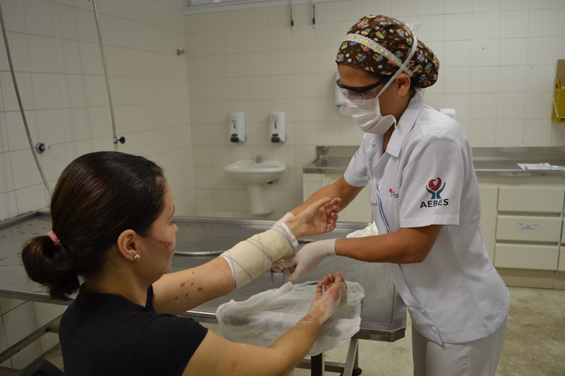 Centro de Tratamento de Queimados do Hospital Dr. Jayme alerta para risco de queimaduras