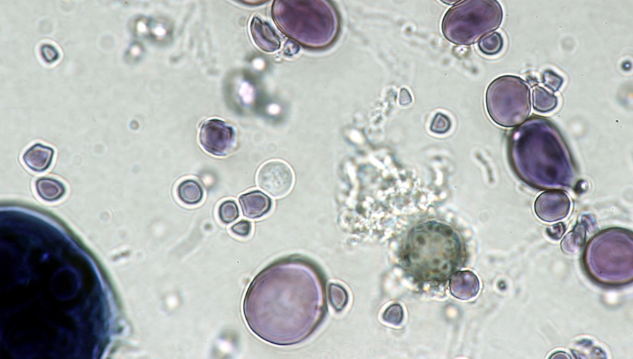 Secult - Frame-de-video_microscopio